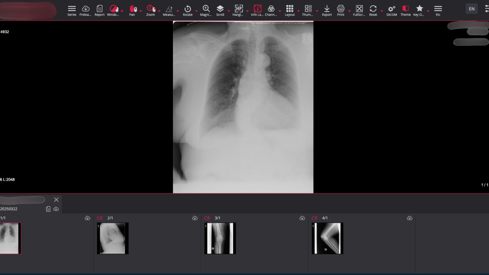 Exposed to the Bare Bone: When Private Medical Scans Surface on the Internet