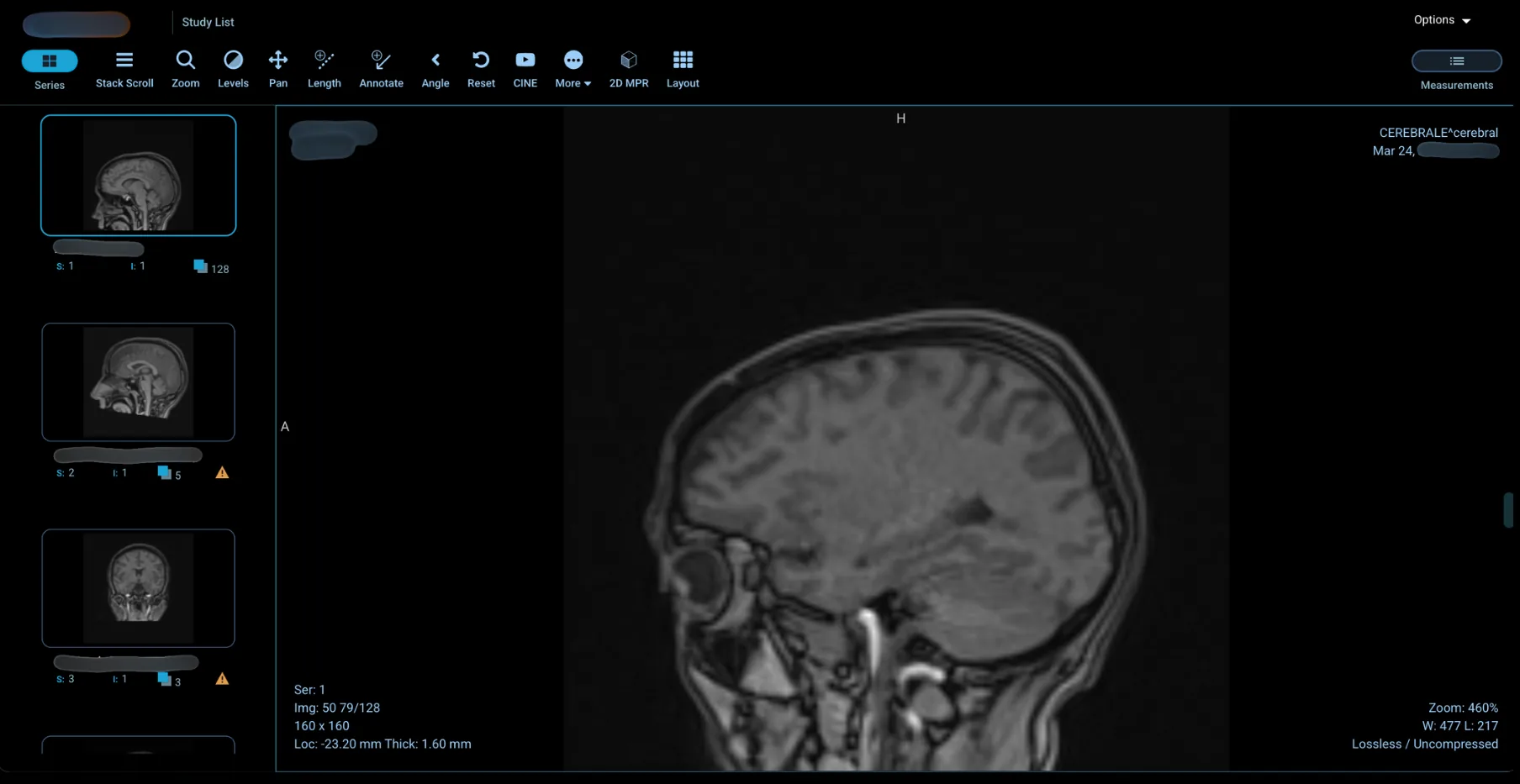 Figure 1: Skull X-ray with Protected Health Information (PHI) accessed through an exposed system