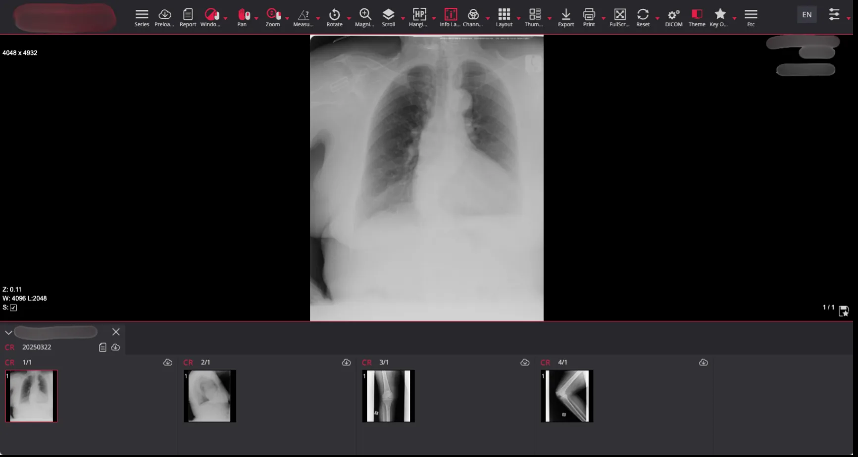 Figure 2: Confidential MRI scan of chest, lungs and leg alongside patient information
