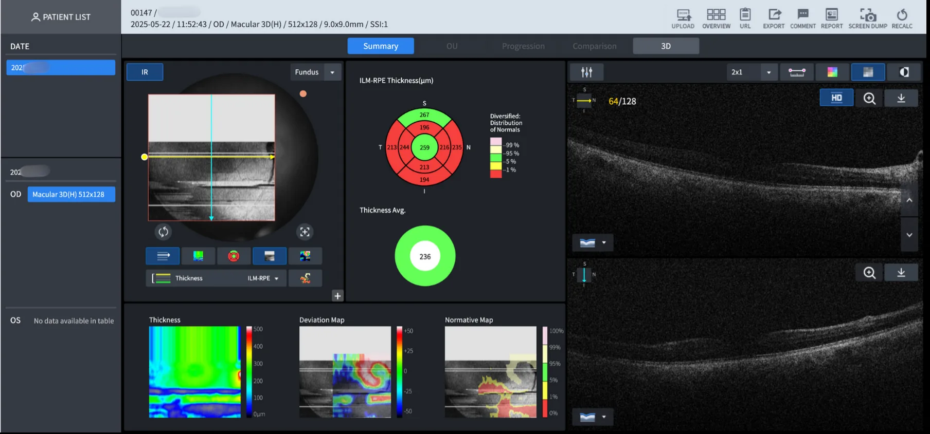 Figure 7: Clickable list of optical results and their personal information