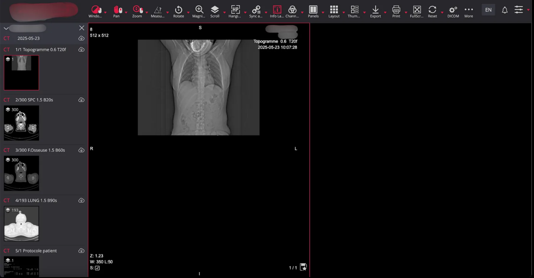Figure 9: Ribcage scan showing detailed diagnostic results with patient information